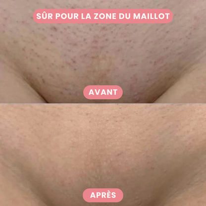 SilkTrim™ - Tondeuse 2-en-1 pour le Maillot et le Visage